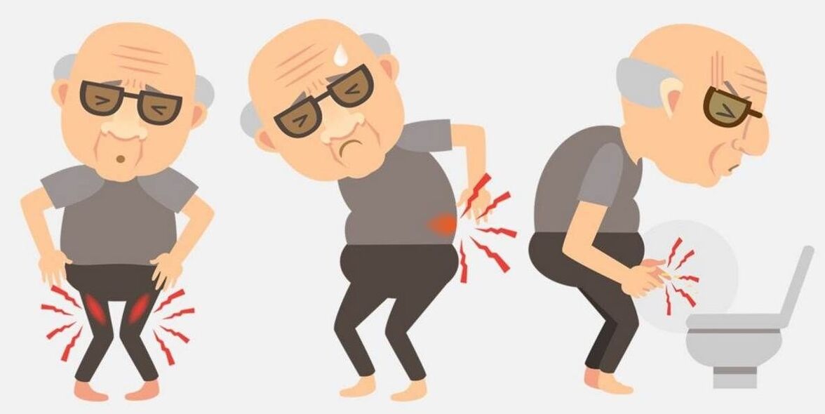 симптоми на простатит